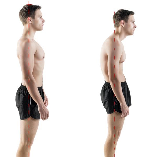 Alterazione della lordosi lombare: posture e movimenti in flessione